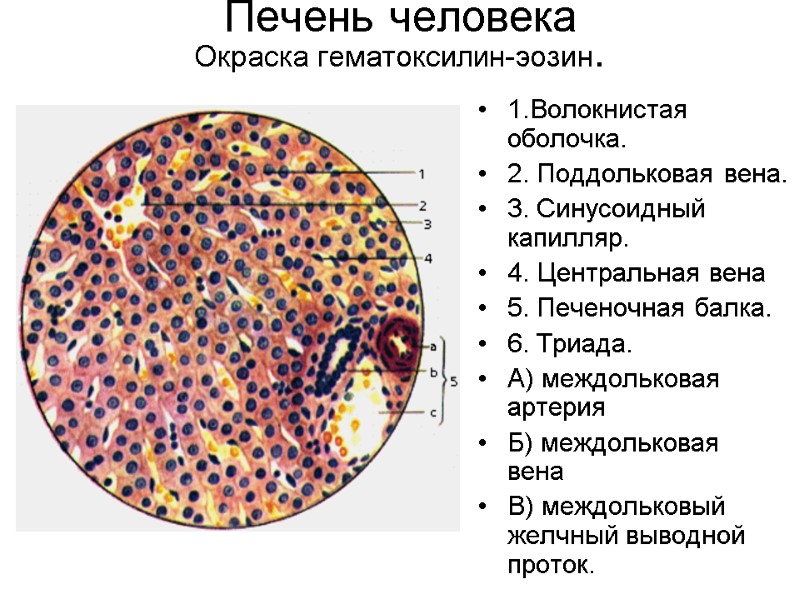 Печень человека Окраска гематоксилин-эозин.  1.Волокнистая оболочка. 2. Поддольковая вена. 3. Синусоидный капилляр. 4.